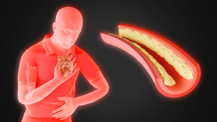 0-Heart_Disease_Crisis_2050