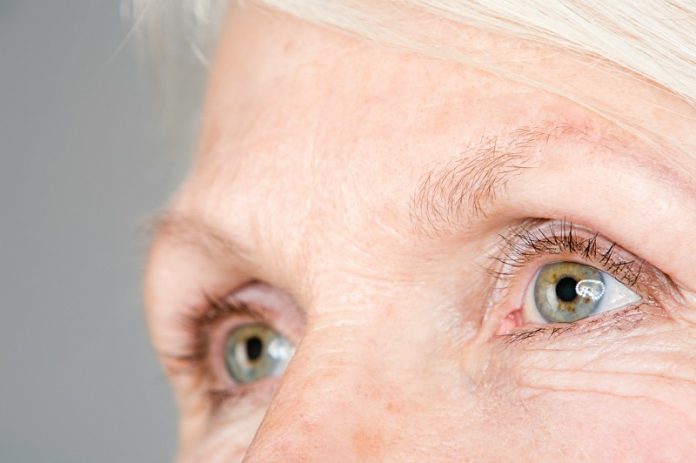 0-Many older people have this vision loss disease without knowing it