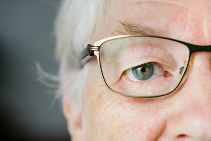 0-Study finds link between rare eye disease and Alzheimer