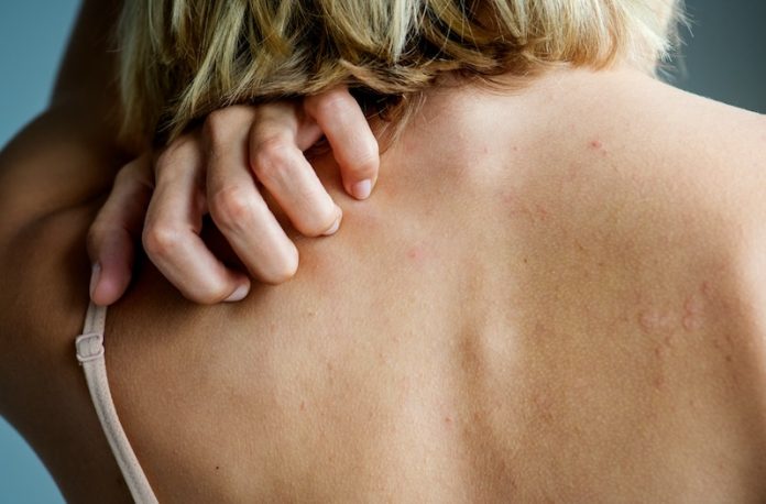 0-kidney_disease_itchy_skin