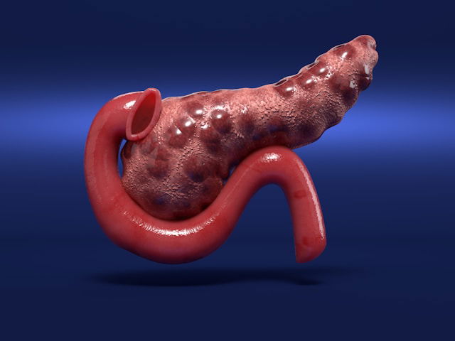 0-pancreatic_cancer_cd9_discovery copy