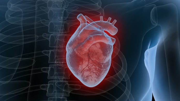 AI predicts sudden heart death with higher accuracy than doctors