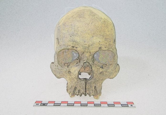 Ancient DNA reveals leprosy existed in the Americas 4,000 years ago