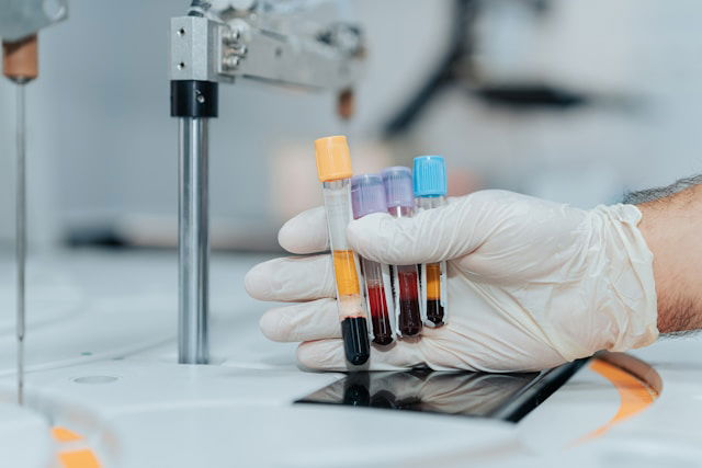 Blood_Test_Detects_Cancer_Years_Earlier