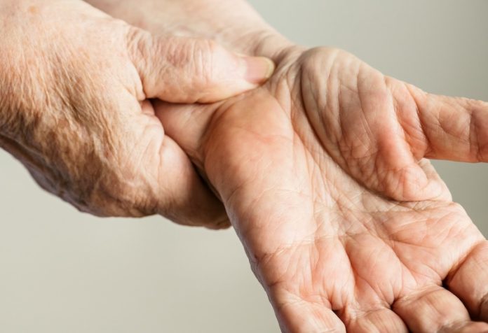 Chronic venous insufficiency