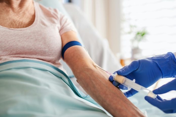 Early stage pancreatic cancer