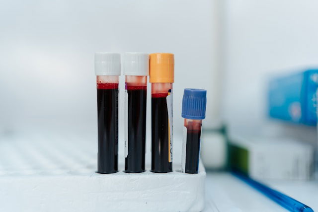 Liver_Cancer_Blood_Test_Knowridge