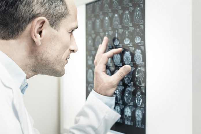 Natural_Ways_to_Lower_Stroke_Risk (2)