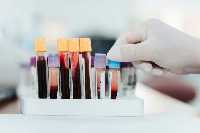New blood test could predict heart disease more accurately
