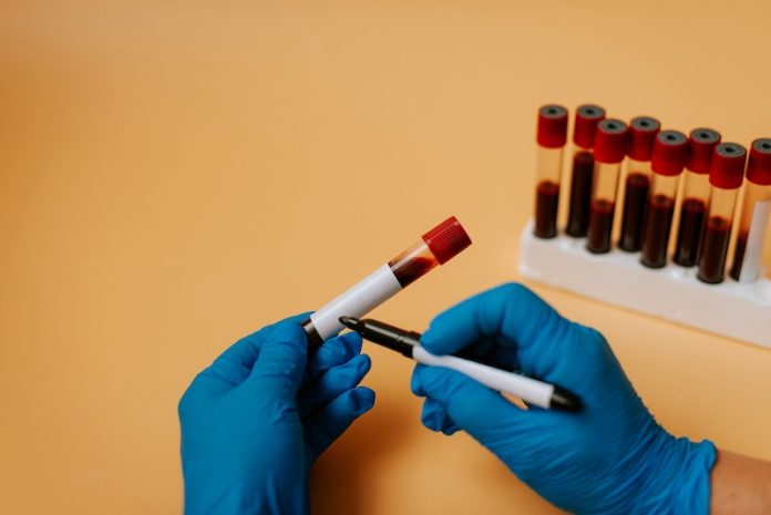 New blood test markers could predict heart disease risk better than cholesterol alone
