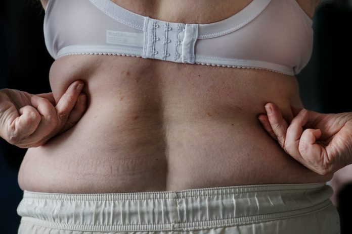 Obesity_Cancer_Deaths_Tripled