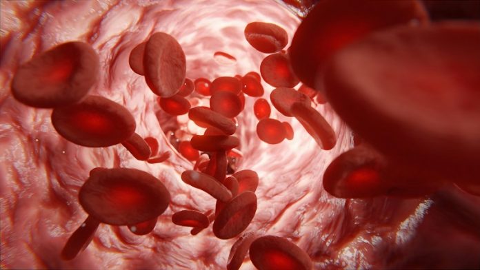 How blocked blood flow can speed up cancer growth by aging the immune system