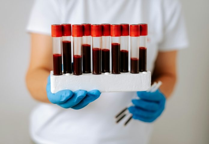 SAFE_Score_Liver_Cancer_Prediction