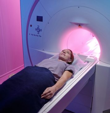 AI could transform how doctors detect brain diseases on MRI scans
